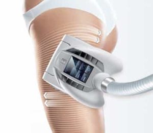 lifestyle non-invasive 356x311-1