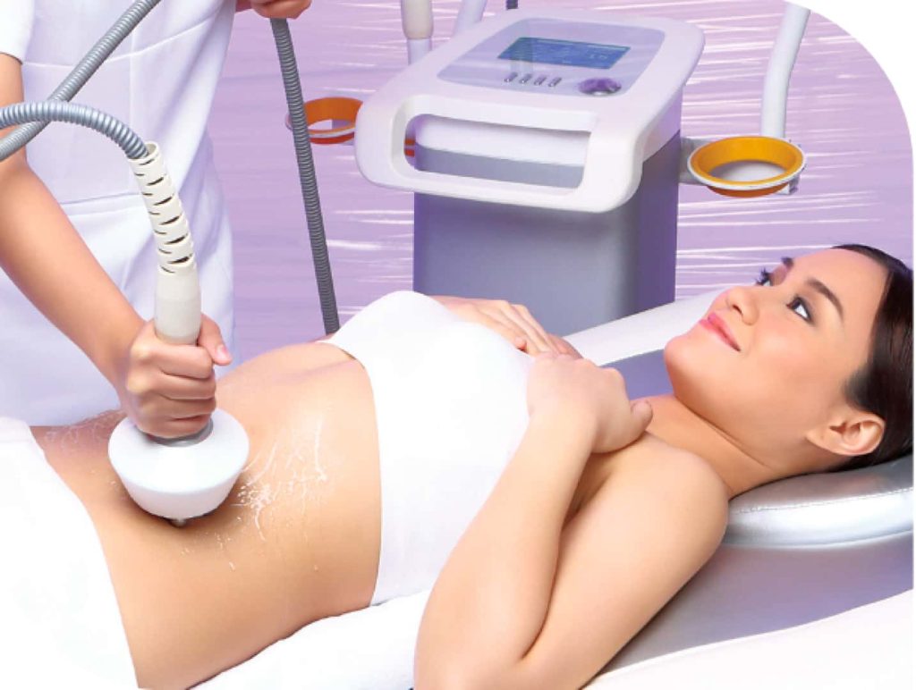 marie france blog image What You Should Know About Non Surgical Fat Removal Treatments for Stubborn Belly Fat 1