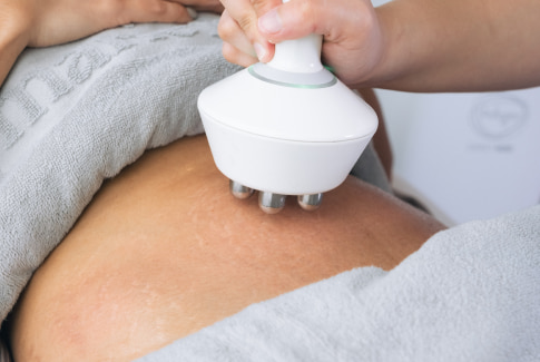 Skin Tightening