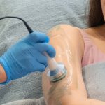 non surgical fat removal banner