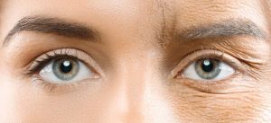 202406 MF WEB ARTICLE BANNERS 2.36